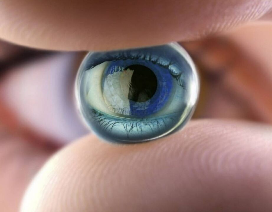 Le lenti notturne ortokeratologiche fermeranno il progresso della compromissione visiva